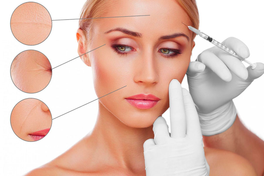 implantes de relleno facial valencia