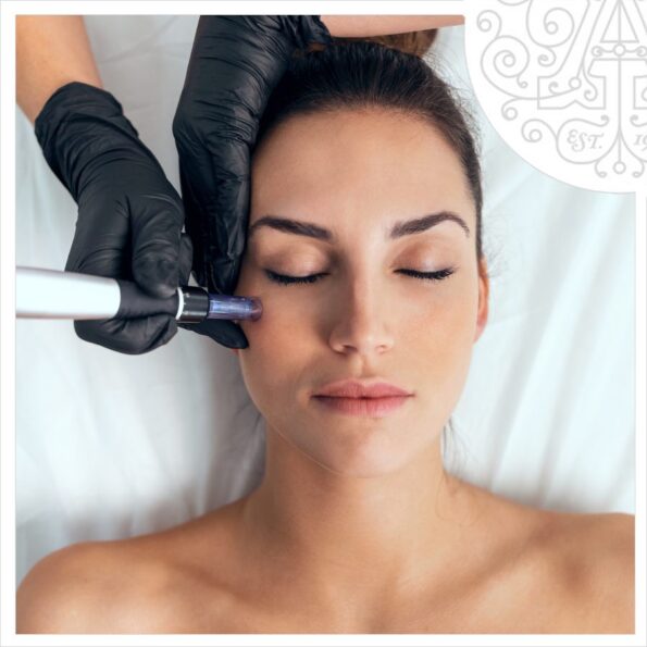 exexomas y microneedling angela rueda