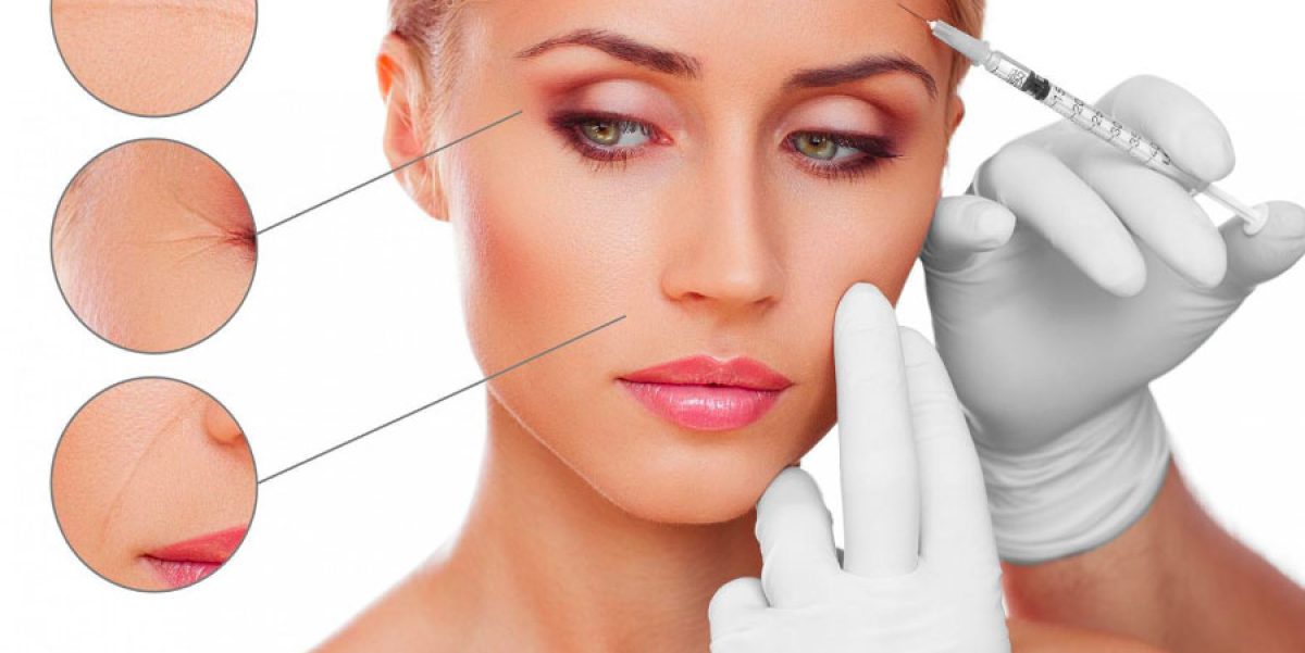 implantes de relleno facial valencia